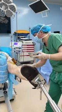 This is how surgery is performed. #shortvideo #doctor