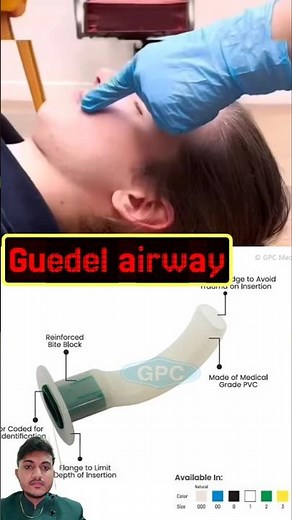 guedel airway #resuscitation #medicaleducation #respiration #ventilation