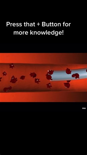 TheVascularGuy on Instagram: "animation - catheters and clotting avatar group.mp4"