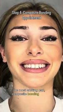 Composite Bonding Process: Step by Step