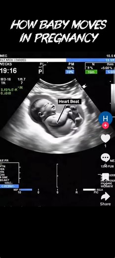 Understanding Baby Movements During Pregnancy