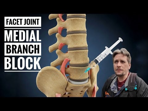 My Experience Having & What is a Facet Joint Medial Branch Block Injection in Spine