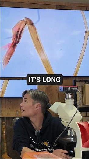 Dragonfly Leg Under the Microscope