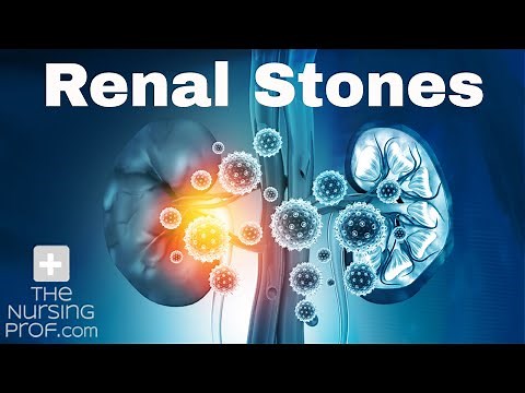 Renal (Kidney) Stones