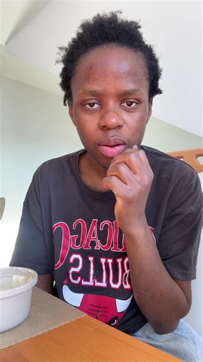 Wise Decision: My Wisdom Teeth Removal Experience 😂