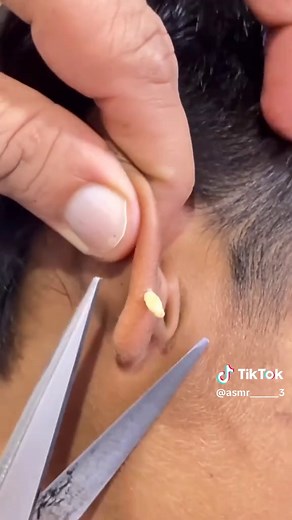 Top ASMR Sounds to Relax and Unwind
