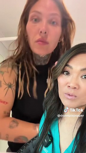 #duet with @Em #cyst i dont think this is a cyst tho… #drpimplepopper #lipoma