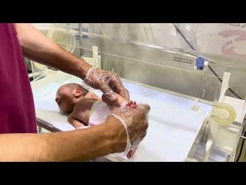 Taking My Baby to Physiotherapy | Gentle Exercises for Infant Development