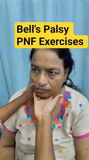 Bell's Palsy PNF Exercises #myhomephysio #physiotherapy #vikhroli