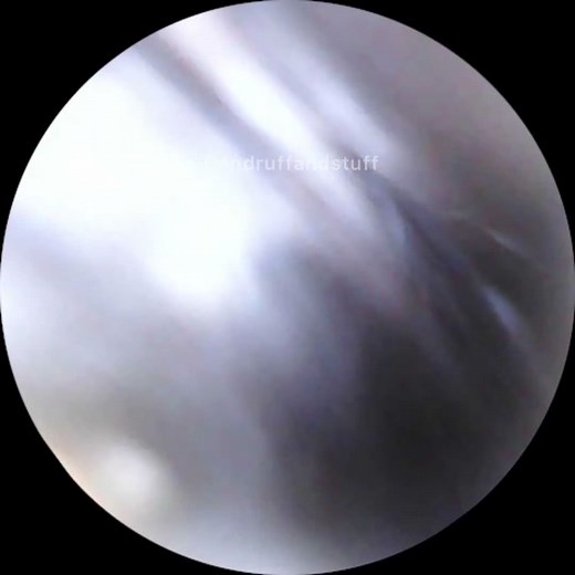 Dandruffandstuff on TikTok