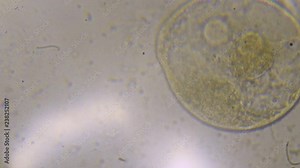 Microscope image footage of protozoa microorganisms in water, showing ciliates, paramecium, bacteria spirochaete and algae.