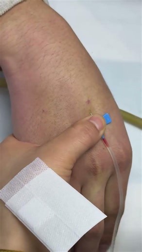 A nurse's daily routine of giving injections#It's time to show off your skills