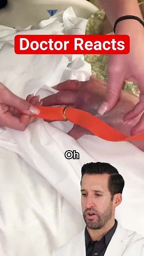 Doctor Reacts to Ring Removal Life Hack | doctor reacts