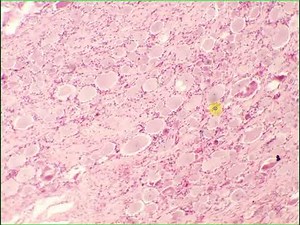 Pseudounipolar, unipolar, sensory neuron, satellite cells Spinal ganglion H&E