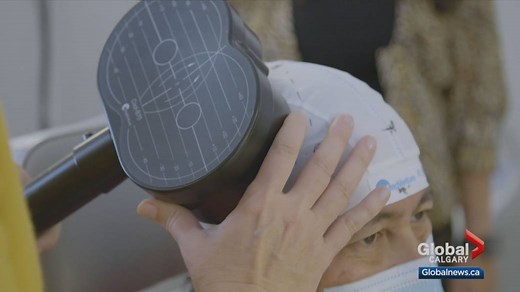 Calgary clinic uses technology over medicine to treat depression