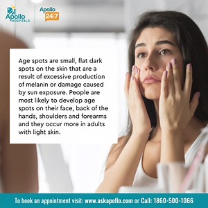 71 reactions | Age spots are small, flat dark spots on the skin that are a result of excessive production of melanin or damage caused by sun exposure. To seek medical opinion, Call Apollo Helpline 1860 500 1066 for assistance. #apollohospitals #askapollo #agespots | Apollo Hospitals | Facebook