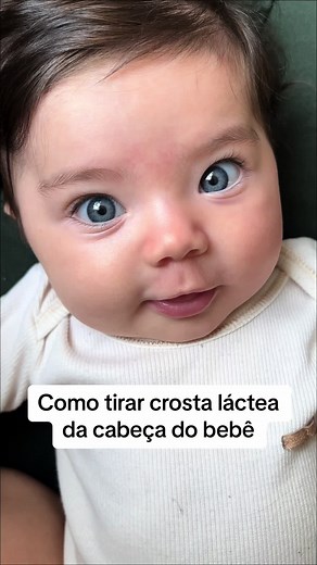 Como Remover a Crosta Láctea da Cabeça do Bebê de Forma Eficiente