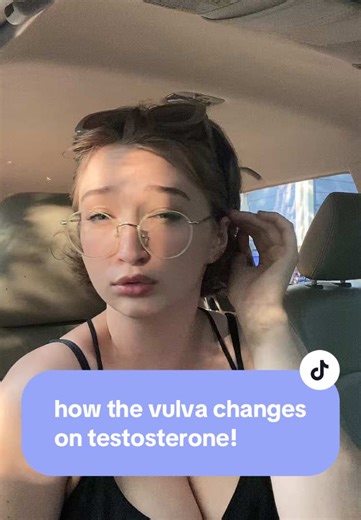 Understanding Metoidioplasty for Transmen