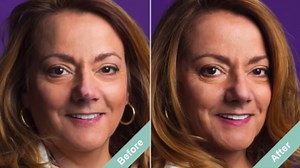 Dermaflage Scar Filler Refill, 4 Applicators