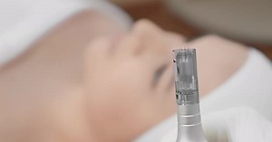 Dermapen Closeup Facial Mesotherapy Fractional in a Beauty Salon As an Ideal Combination of Science