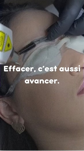🇧🇷🇵🇹🇱🇺 | Esthétique Avancée Luxemburgo on Instagram: "RETRAIT DE TATOUAGE La Technologie laser picoseconde est aujourd’hui l’une des technologies les plus avancées et sécurisées en esthétique. Grâce à des impulsions ultra-courtes, le laser fragmente les pigments en particules très fines, permettant à l’organisme de les éliminer progressivement, sans agresser la peau environnante. de toutes les zones du corps de toutes les couleurs de pigments avec une précision élevée et un respect optimal