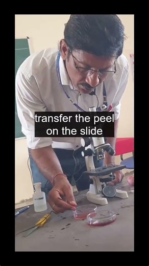 Onion Peel Slide 🔬 | See Cells in 2 minutes ! #Shorts