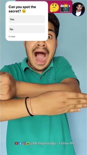 “Don’t Blink… My Thumb Disappears! 👀✨”