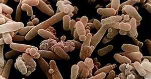 A New Genetic Map That Could Make Your Skin Crawl