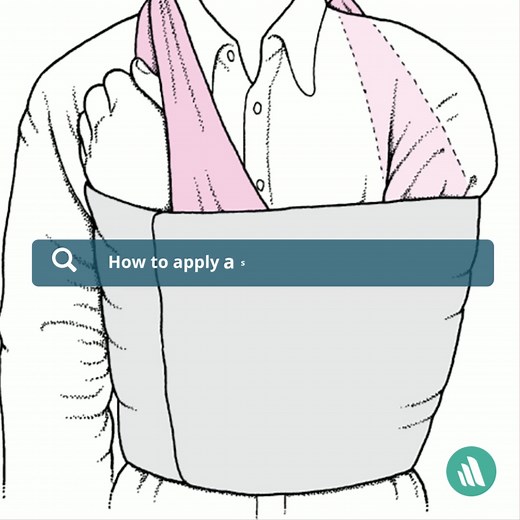 33 reactions · 13 shares | A shoulder sling and swathe are used to both support the arm and immobilize the shoulder. Refresh your knowledge on how to apply them: https://mrkmnls.co/3DKcer6 | Merck Manual Professional | Facebook