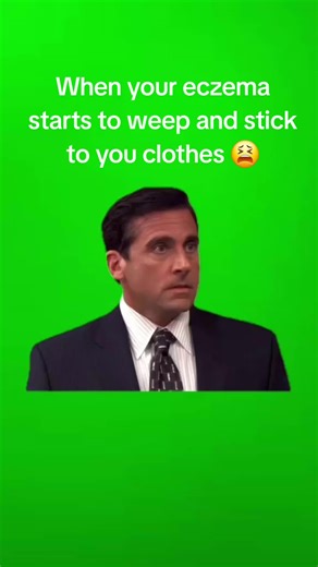 #pain #eczema #skinproblem #dryskin #itchy