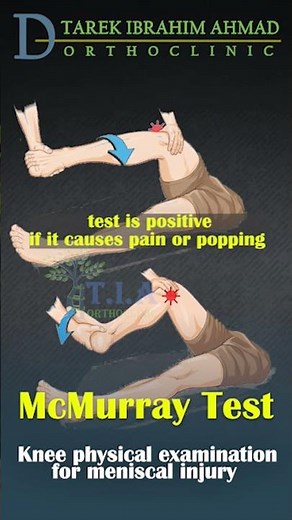 🔥 Knee Pain? Try This McMurray Test for Meniscus Injury!