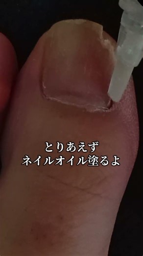 爪ボロボロだから、ネイルオイルで育爪だ!#セルフケア #ネイル #nails #育爪