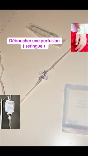 Déboucher une perfusion : Guide pratique pour infirmiers