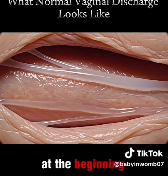 What Normal vaginal Discharge Looks like #babyinwomb #pregnanttiktok #pregnantlife #pregnant🤰