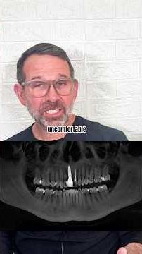 Fixing 2 front teeth with veneers - Cosmetic Dentist Case Review