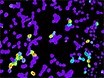 Controllable Ion Channel Expression through Inducible Transient Transfection