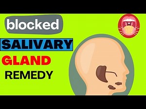 5 Natural Home Remedies to Unblock Your Salivary Glands