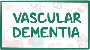 Vascular dementia: Video, Causes, & Meaning | Osmosis