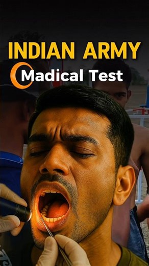 Army Medical Test में सबसे ज़्यादा Reject यहीं होते हैं | Indian Army madical test #shorts #army