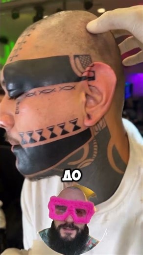 Download the tattoo removal price list from my profile header.