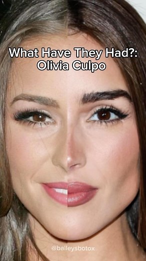 Molly Bailey - The STL Injector on Instagram: "What have they had?: Olivia Culpo They wanna know - who’s that girl and what has she had? We’re still over here obsessing over OC’s glow up. Although she was open about much of her injectable work, I think there’s still some gatekeeping going on. Gatekeeping aside, Olivia is one of my favorite examples of how non-surgical aesthetic treatments should enhance natural beauty and not distort it. Her undetectable tox and filler seamlessly integrates and