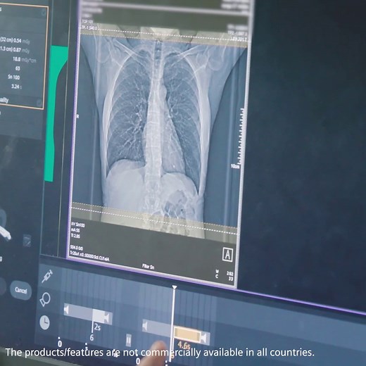 15K views · 158 reactions | All it takes are a couple minutes: Learn how lung screenings with ultra-low dose CT scans have the potential to improve chances of survival of lung cancer. https://www.siemens-healthineers.com/perspectives/lung-cancer-screening-acceptance?stc=wwhc242914 | Siemens Healthineers | Facebook