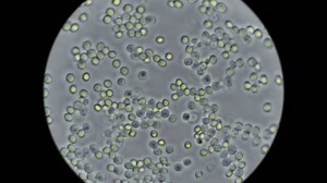 Yeast Under Microscope Used Baking Bread Stock Footage Video (100% Royalty-free) 1027797482 | Shutterstock