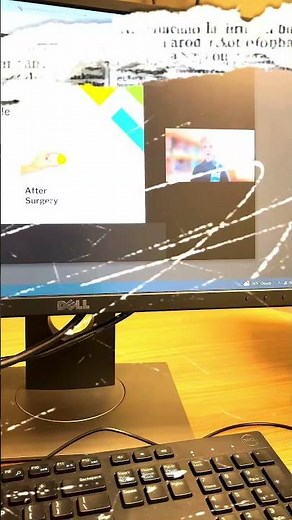 #fypviral #bypass #weightlossjourney #simplywinterm #viral #fypage #viralvideos #vlog #viralshorts