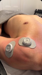 ⚡ A TENS machine works by stimulating nerves and increasing blood flow, helping to relax tight muscles and ease soreness. @coddy1990 came to me today with an impact injury and in response his shoulder tightened up to defend it self. A a great way to end the session after some light massage therapy was to use the TENS  #TENSMachine #MuscleRelief #RecoverBetter | TC Sports Massage | Facebook