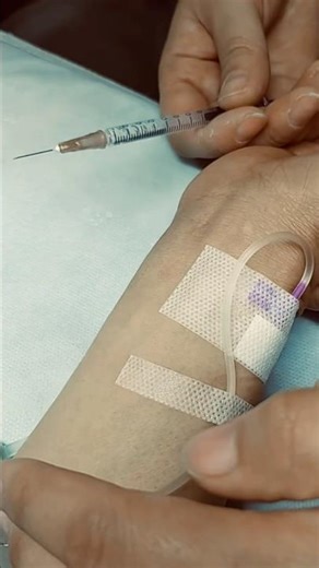 “Smooth Injection Technique 💉🔥 Satisfying Medical Skill in Action!” #medicalstudent
