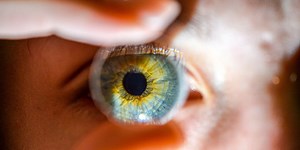 Dr. Pimple Popper Just Squeezed A 'Third Eye' Cyst From A Man's Eyebrow