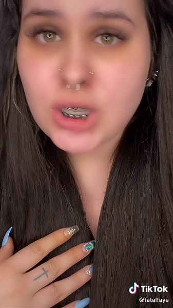 Smiling with Braces: The Journey to Front Teeth