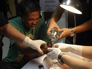 Firecracker-related injuries up to 181; ‘piccolo’ still most notorious