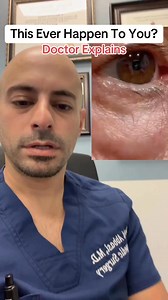 1.3M views · 4.5K reactions | Does Your Eye Twitch?✅Follow @drdavidabbasi for More Daily Medical Content & Health Tips! Schedule a consultation to see Dr. Abbasi as a patient in Delray Beach! Visit www.primeorthocenter.com #myokymia #doctor #medical | David Abbasi, MD - Sports Medicine & Orthopedic Surgery | Facebook